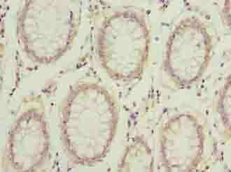 COMMD2 Antibody