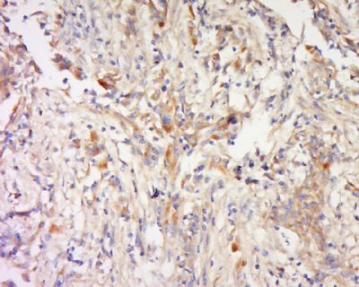 COMMD7 Rabbit Polyclonal Antibody