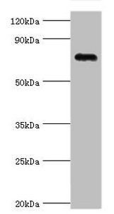 COMP antibody