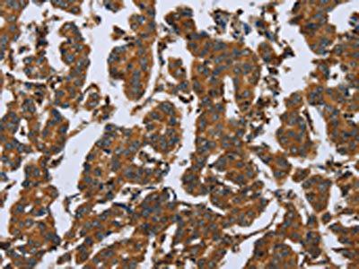 COMP Antibody