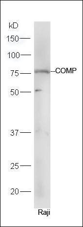 COMP antibody