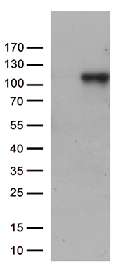 Complement Component 6 (C6) antibody