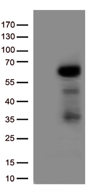 Complement Component 6 (C6) antibody