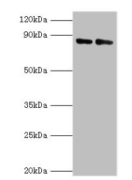 Complement factor B antibody