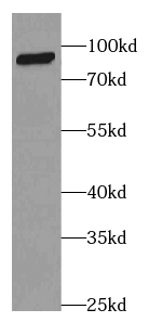 Complement factor B antibody