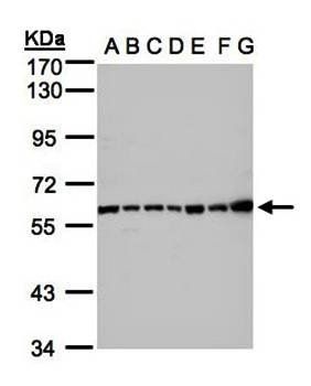 Complement C2 antibody