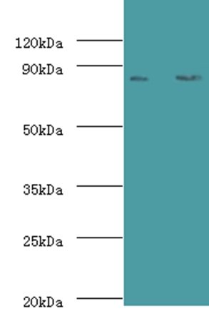 Complement factor B antibody (Biotin)