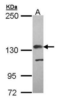 Complement factor H antibody