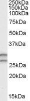 Goat anti-COMT (N Terminus) Antibody