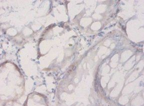Connective tissue growth factor antibody