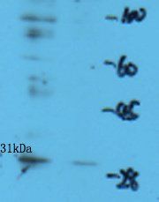 GJB3 Rabbit Polyclonal Antibody