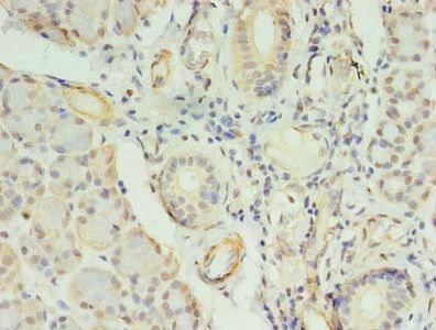 COPB1 Antibody