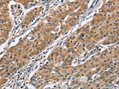 COPB1 Antibody