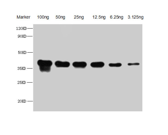 Copper-metallothionein Antibody