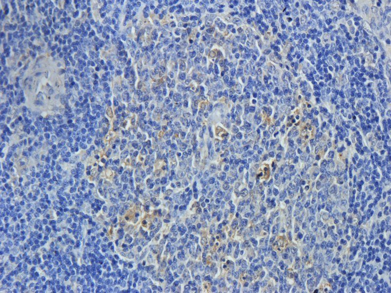 COPS2 Rabbit Polyclonal Antibody