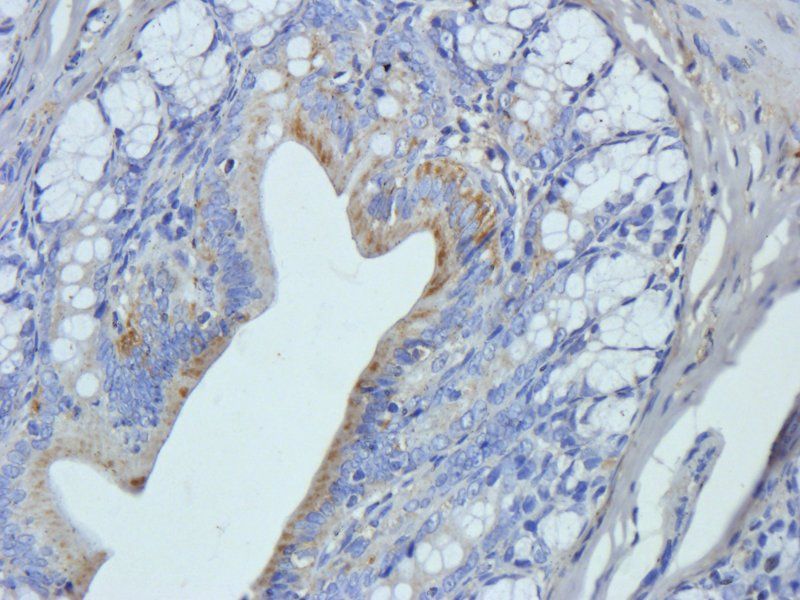 COPS2 Rabbit Polyclonal Antibody