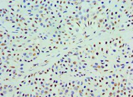 COQ7 antibody