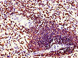 CORO1A Antibody
