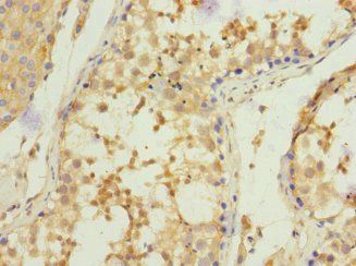 CORO1C Antibody