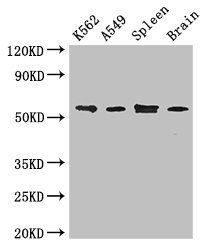 CORO1C Antibody