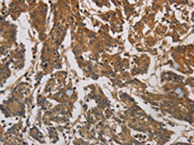 CORO1C Antibody