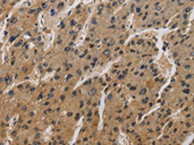 CORO1C Antibody