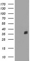 Coronin 1a (CORO1A) antibody