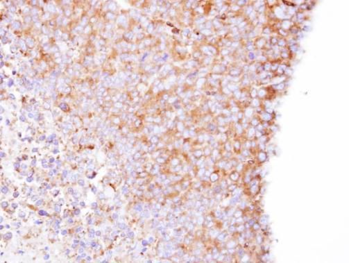 Coronin 1B Rabbit Polyclonal Antibody