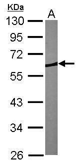 Coronin 1B Rabbit Polyclonal Antibody