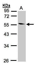 Coronin 1B Rabbit Polyclonal Antibody