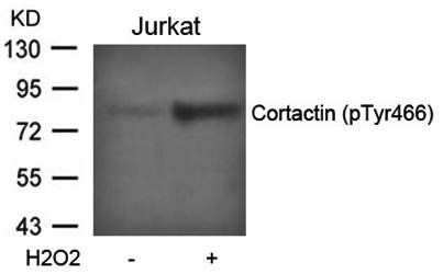 Cortactin (Phospho-Tyr466) Antibody