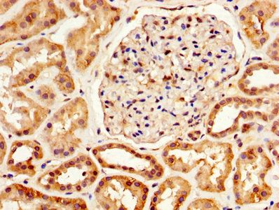 Corticosteroid-binding globulin antibody