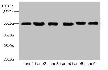 Corticotropin-releasing factor R 1 antibody