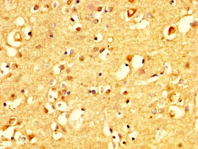 CRHR1 Antibody