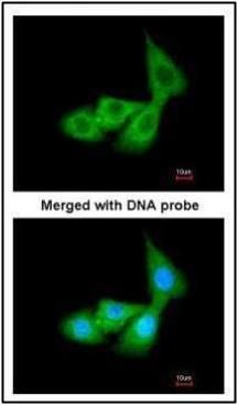 Cortisol Binding Globulin antibody [N2C3]