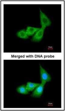 Cortisol Binding Globulin antibody