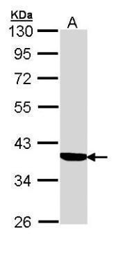 Cortisol Binding Globulin Rabbit Polyclonal Antibody