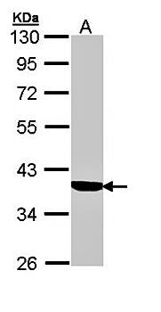 Cortisol Binding Globulin antibody