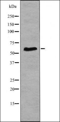 Cot (Phospho-Ser400) antibody
