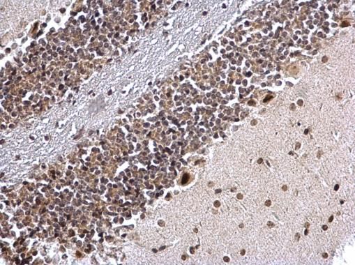 COUP TF1 Rabbit Polyclonal Antibody