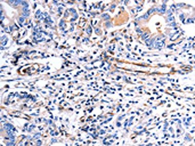 COX11 Antibody