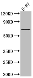 PTGS2 Recombinant Monoclonal Antibody
