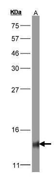 COX5B Rabbit Polyclonal Antibody