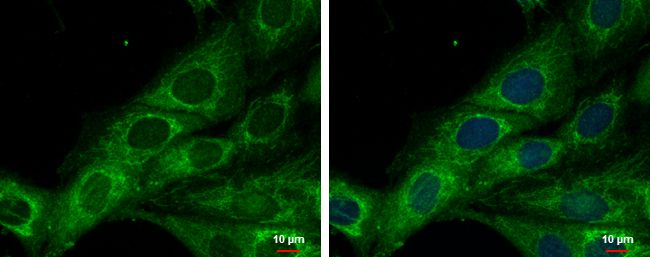 COX6A2 antibody