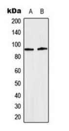 STAT5 (phospho-Y694/699) antibody
