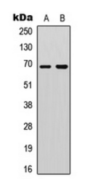 DDX5 (Phospho-Y593) antibody