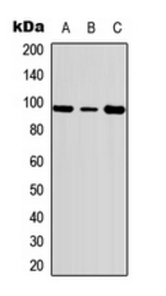 FER (Phospho-Y402) antibody