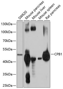 CPB1 antibody
