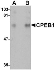 CPEB1 Antibody