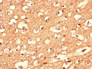 CPLX1 Antibody